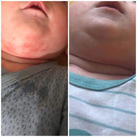 Medarek Zinková mast s propolisem BIO 50 ml