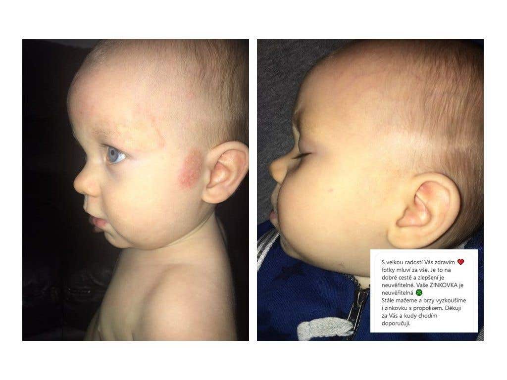 Medarek Zinková mast s propolisem BIO 50 ml