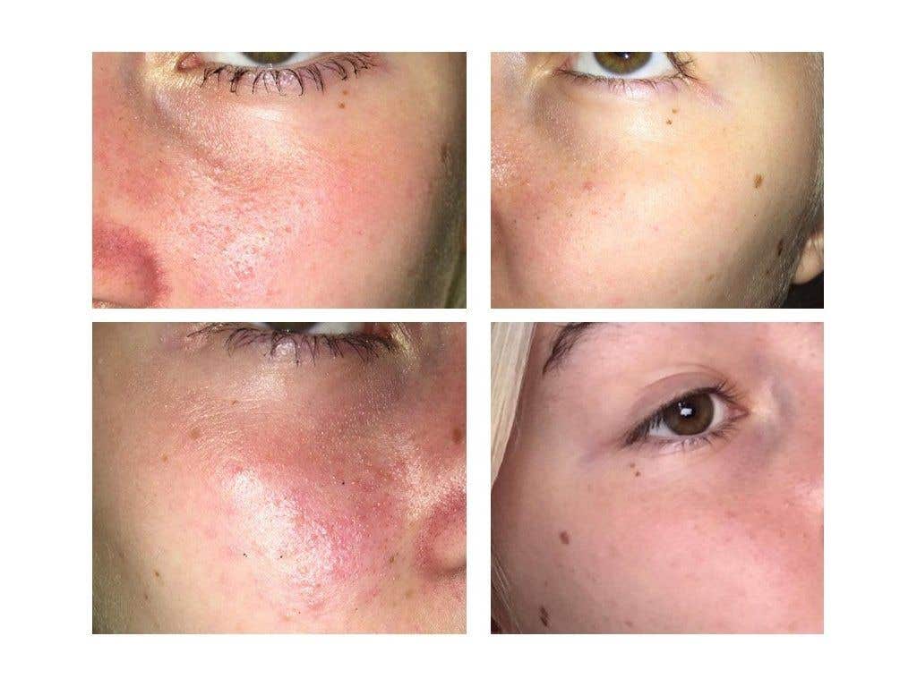 Medarek Zinková mast s propolisem BIO 30 ml