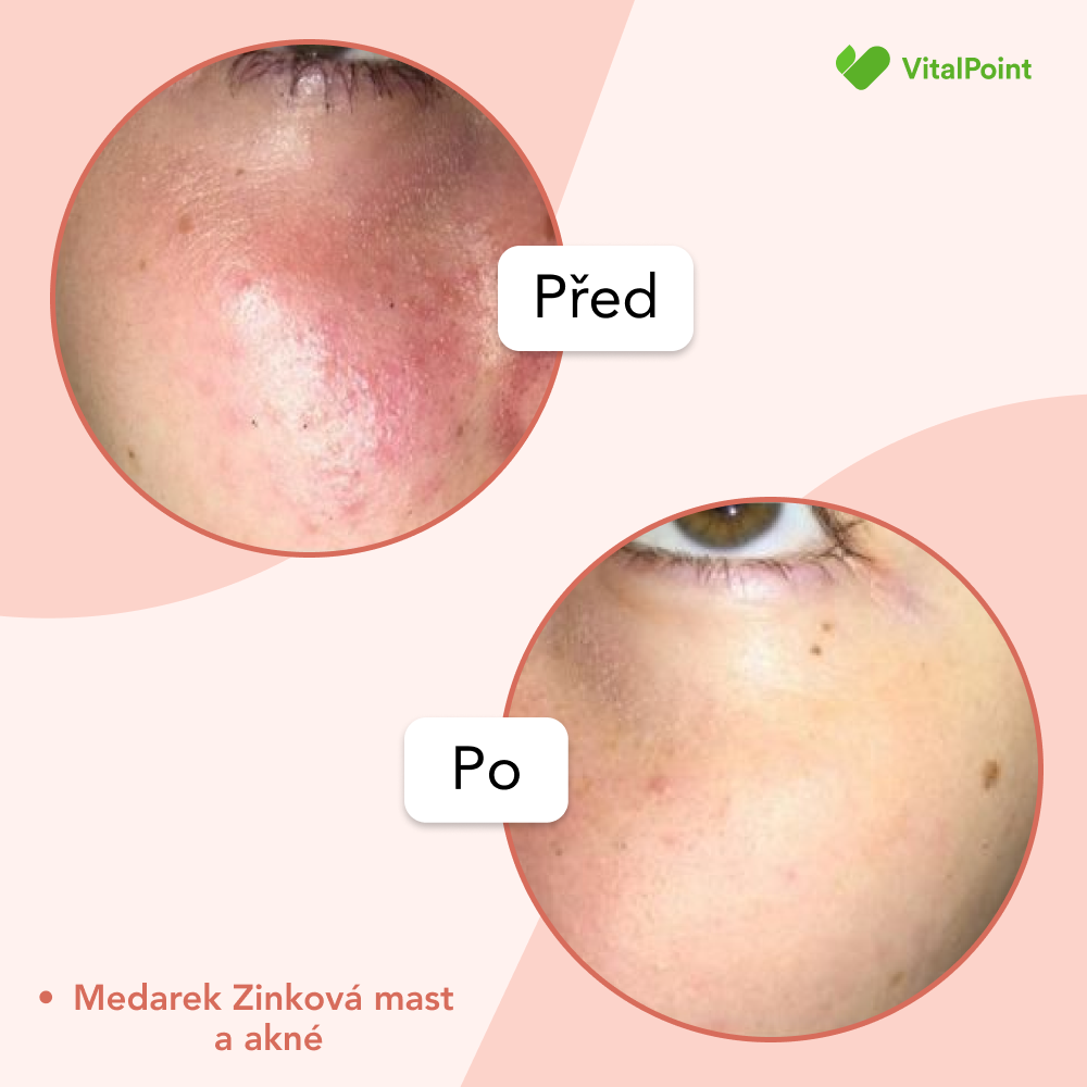 Medarek Zinková mast BIO 100 ml