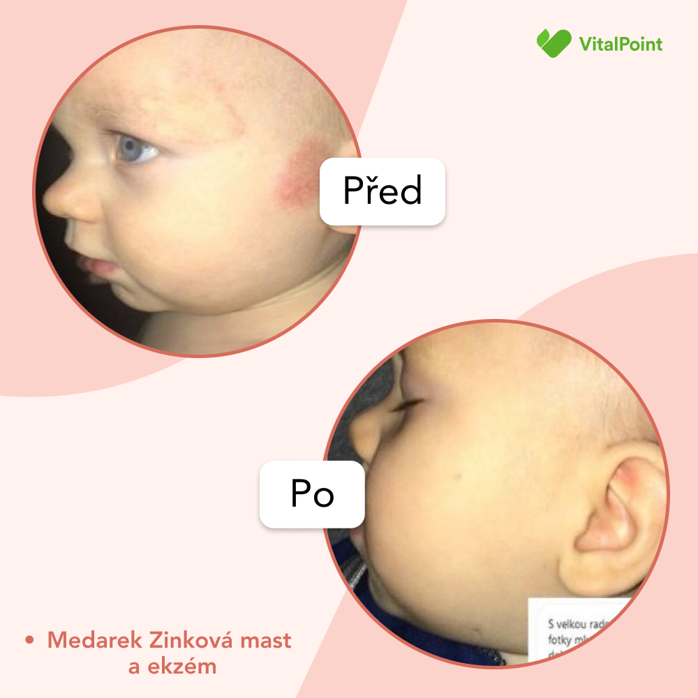 Medarek Zinková mast BIO 100 ml