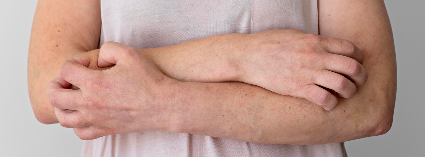 Kožní a nehtové plísně – prevence a léčba